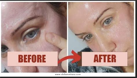 tca peel reviews|TCA Peel at Home: Benefits, Instructions, Side Effects and More.